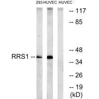 RRS1 Antibody (PACO22580)
