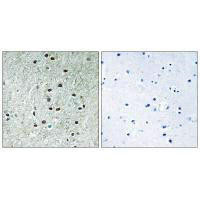 REXO1 Antibody (PACO22582)