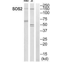 SOS2 Antibody (PACO22628)