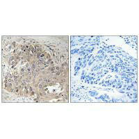 SPTBN5 Antibody (PACO22631)