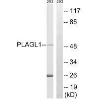 PLAGL1 Antibody (PACO22735)