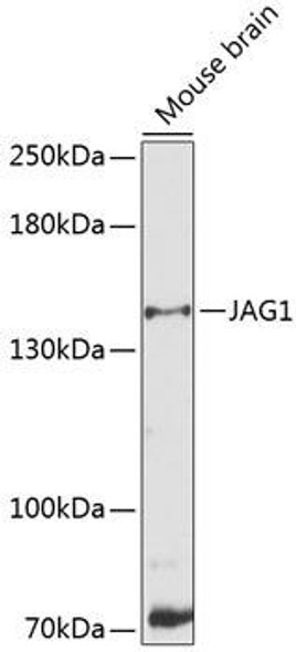 Anti-JAG1 Antibody (CAB12754)