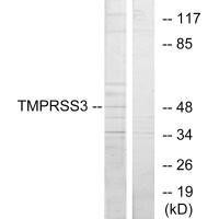 TMPRSS3 Antibody (PACO23236)