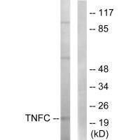 LTB Antibody (PACO23242)