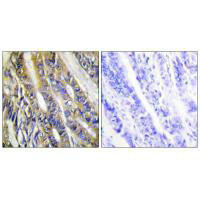DGKH Antibody (PACO23260)