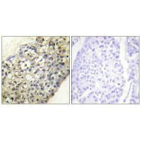 BPIFA4P Antibody (PACO23261)