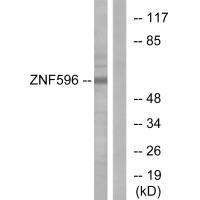 ZNF596 Antibody (PACO23269)