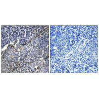 COL19A1 Antibody (PACO23321)