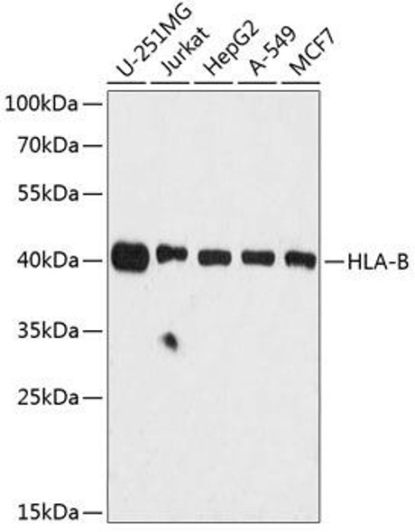 Anti-HLA-B Antibody (CAB1285)