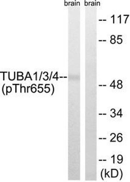 Phospho-TUBA1A/TUBA1B/TUBA1C/TUBA3C/TUBA3E/TUBA4A (Tyr272) Antibody (PACO24172)