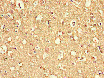 DNAJC6 Antibody (PACO26273)