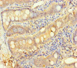 TESPA1 Antibody (PACO27785)