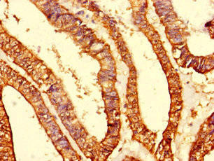 MRPS10 Antibody (PACO28370)