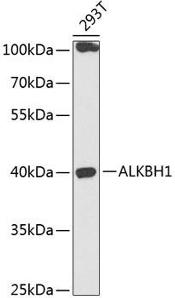 Anti-ALKBH1 Antibody (CAB14079)