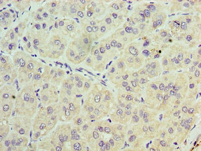TRBC1 Antibody (PACO30790)