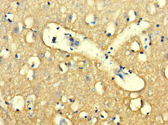WDR27 Antibody (PACO31068)
