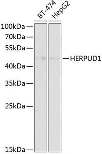 Anti-HERPUD1 Antibody (CAB14097)