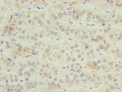 ZNF622 Antibody (PACO31428)