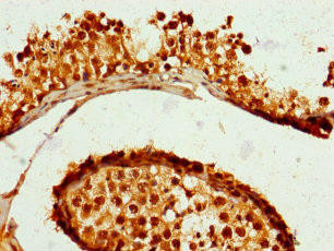 ZNF679 Antibody (PACO31460)