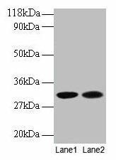 MRPL9 Antibody (PACO31876)