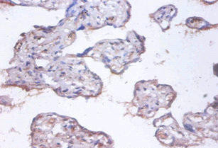 COMMD4 Antibody (PACO31884)