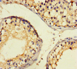 CTDNEP1 Antibody (PACO31964)