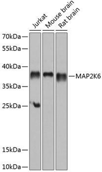 Anti-MAP2K6 Antibody (CAB14191)