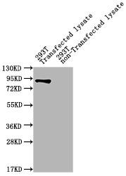 ureB Antibody (PACO33444)