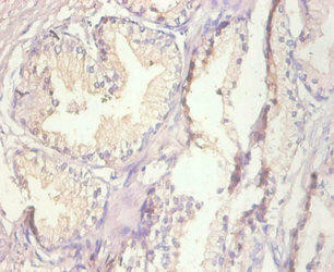 MT1A Antibody (PACO33828)