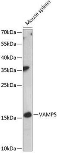 Anti-VAMP5 Antibody (CAB14371)
