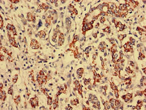 RTCA Antibody (PACO35094)