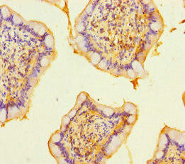 RASGEF1B Antibody (PACO35246)