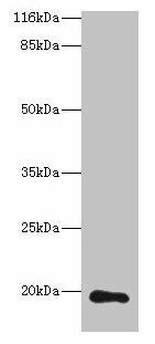 RAB30 Antibody (PACO35326)