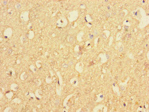 RAB40B Antibody (PACO35438)