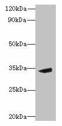 MPPED2 Antibody (PACO35534)