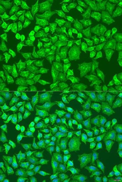 Anti-DVL2 Antibody (CAB14726)