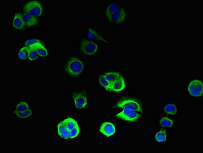 ORMDL2 Antibody (PACO36194)