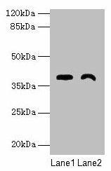 TMEM255A Antibody (PACO36274)