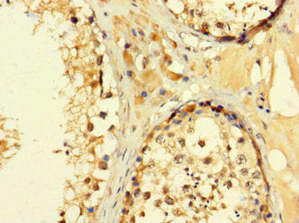 C2orf83 Antibody (PACO36290)