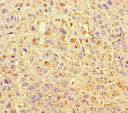 KIF24 Antibody (PACO36366)