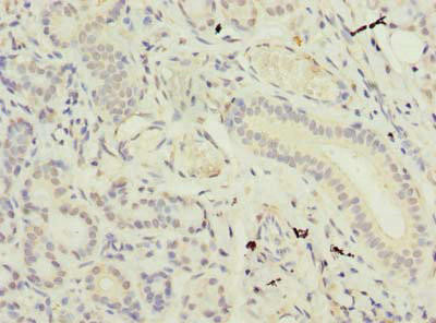 SUSD4 Antibody (PACO36606)