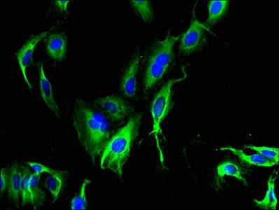 CATSPER4 Antibody (PACO36806)