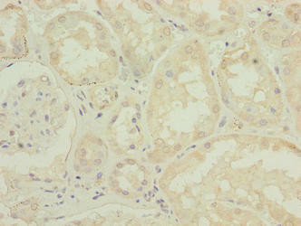 DPH6 Antibody (PACO36926)