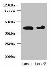 ASPHD2 Antibody (PACO37058)
