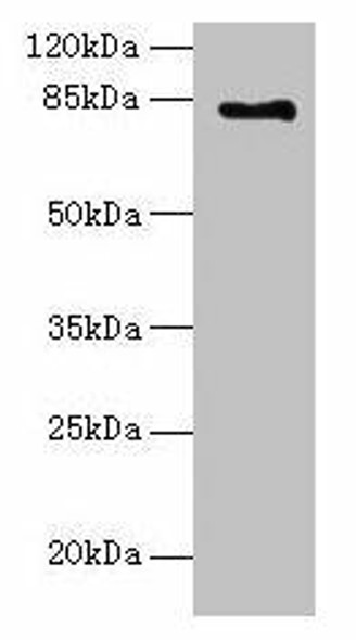LCA5 Antibody (PACO37306)