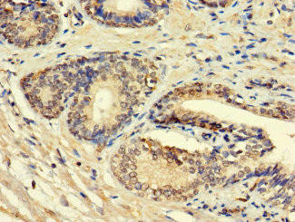 HSD11B1L Antibody (PACO37334)
