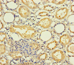 MRPL21 Antibody (PACO37426)