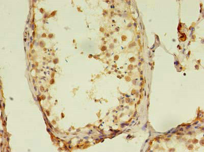 RTKN2 Antibody (PACO37682)