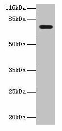 KBTBD2 Antibody (PACO37710)