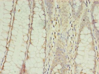 CPNE9 Antibody (PACO37746)